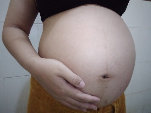 35+5w