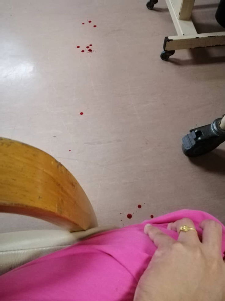 2nd Baby - EDD - 26/01/2020 (Foley Balloon Cathether)