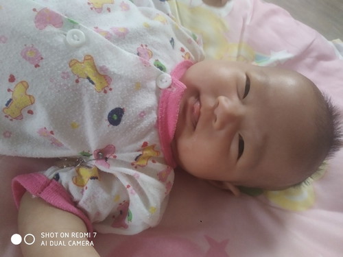 2เดือน11วัน น.น.4.5โล