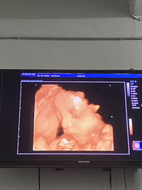 มุก profile icon