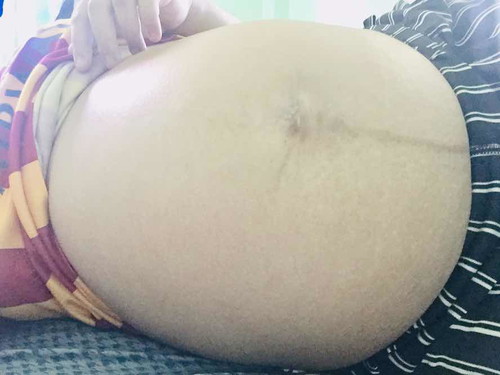 หมอบอกน้องกลับหัวแล้ว