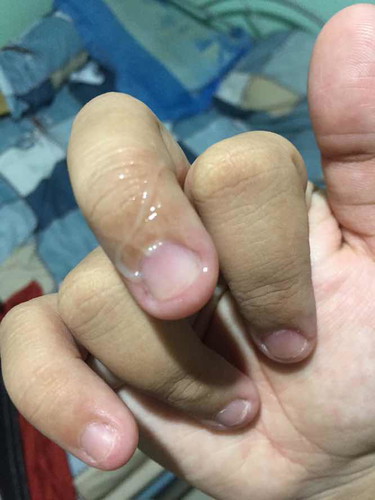 แบบนี้คืออะไรคะแม่ๆไม่เคยเป็นค่ะ