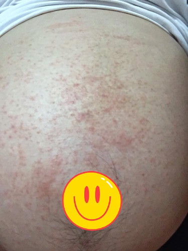 36+4 days