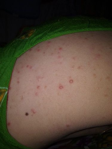 maaf jika gambar tidak nyaman untuk di lihat