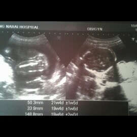 ถามแม่ๆคัยดูออกบ้าง