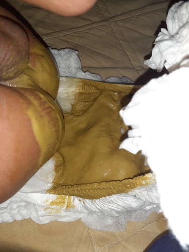 น้องอึแบบนี้เป็นอะไรไหมคะ?