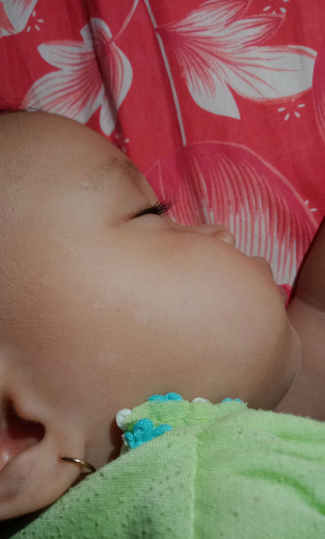 Bercak putih, PANU kah ??