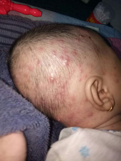 Biang Keringat Ga berhenti