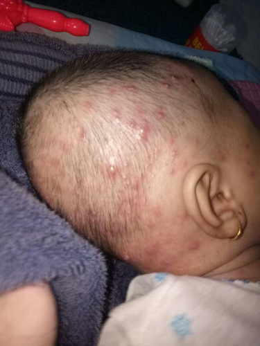 Biang Keringat Ga berhenti