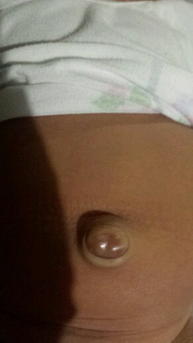 Baby's Navel