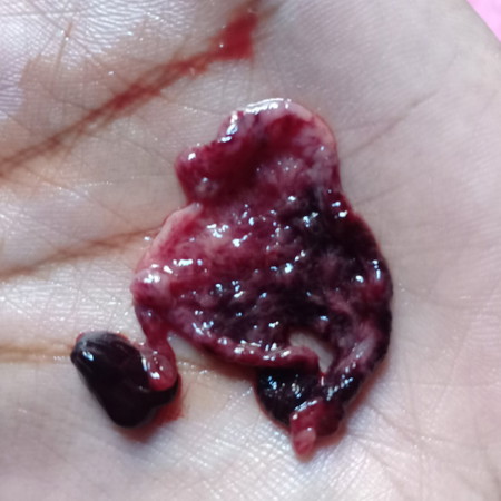 maaf gambar agak kotor..