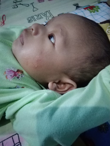 ruam