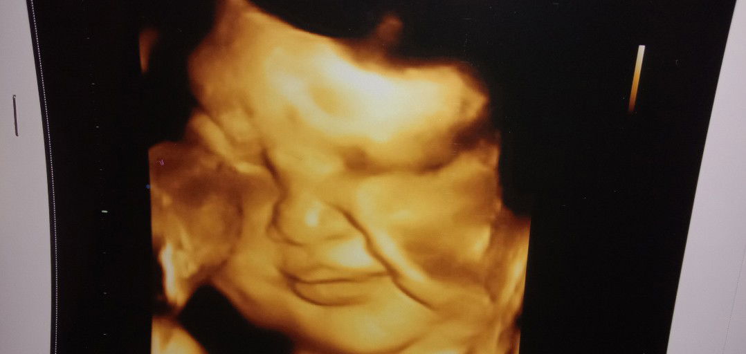 39w5d masih betah didalem