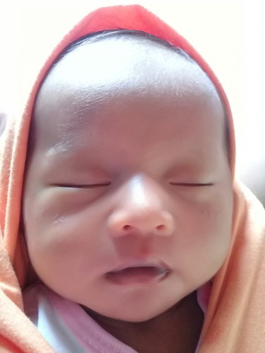 bintik diwajah