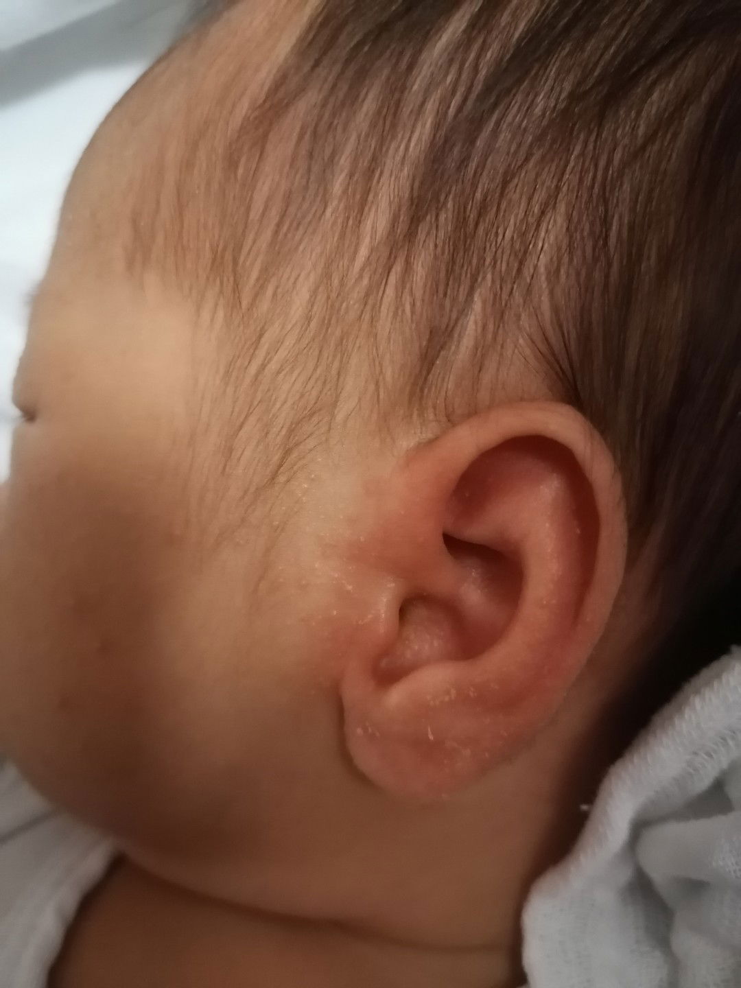 Rashes At Nagbabalat Ftm