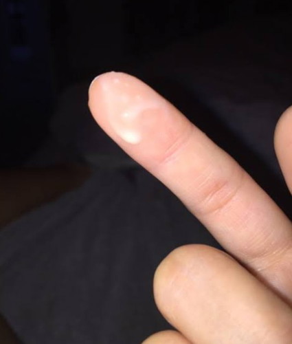 mucus