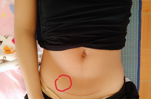 ขออภัยหากรูปดูไม่สุภาพ