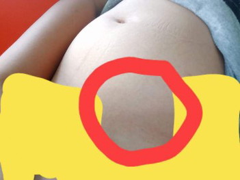 แม่อาการแบบนี้เป็นอะไรไหมคะ