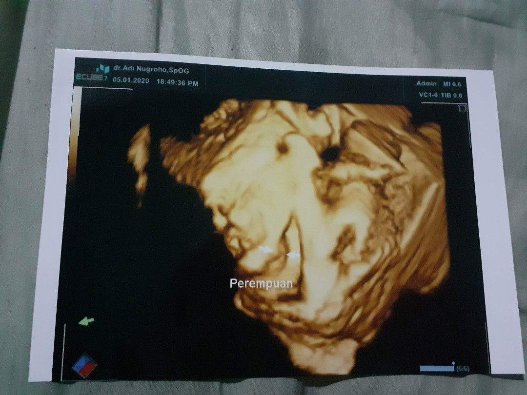 Takut semoga tidak terjadi