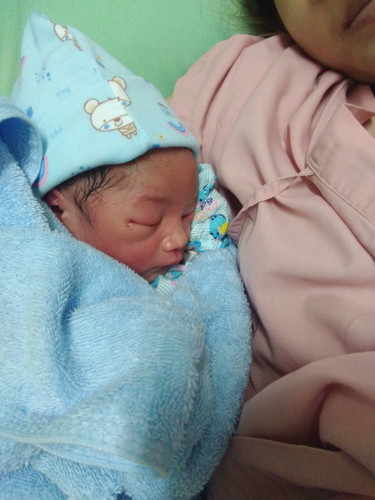 ผ่าคลอดคะ