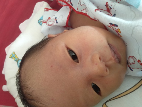 จุดสีแดงแบบนี้คืออะไร