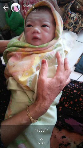 Umur 17 thun mnjadi ibu barru?