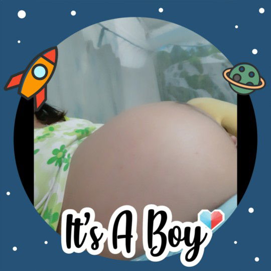 ท้อง2ผ่าคลอดกันกี่วีคค่ะ(ท้องแรกผ่าค่ะ)