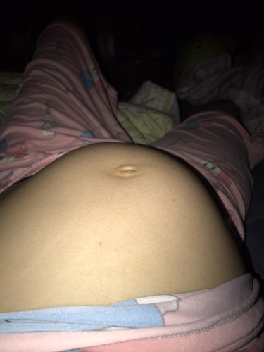 28w ท้องสอง ท้องแข็งเป็นบางวัน กำหนด31มีนา63