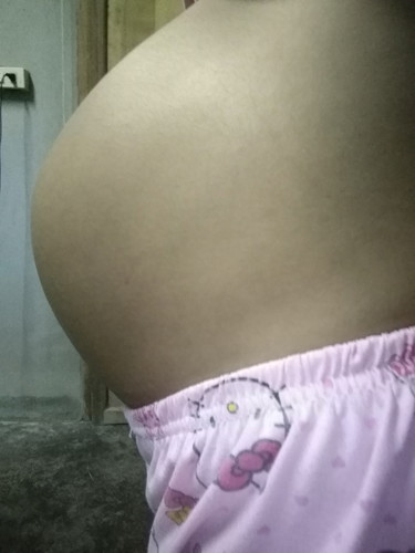 8ด.