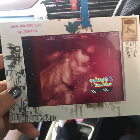 #ผมหล่อป่าวค่าบบบบบบ