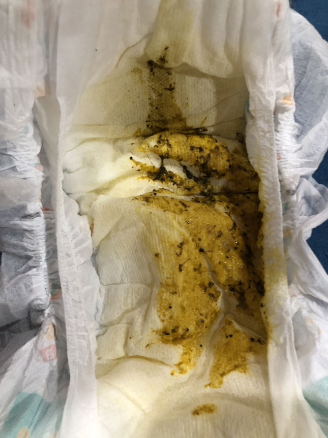 1 month and 26 day old