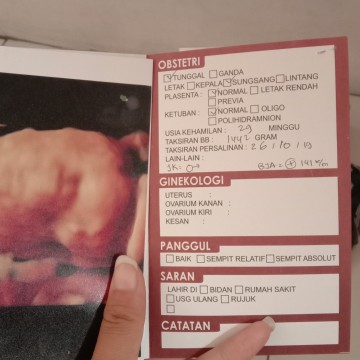 29 weeks sungsang ,,