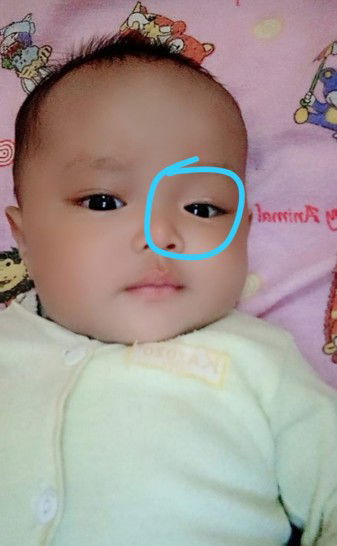 garis putih di kelopak mata