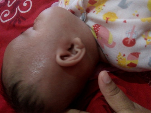 bintik" merah dikepala