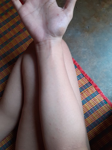 ใครเป็นเหมือนกันบ้างคะ