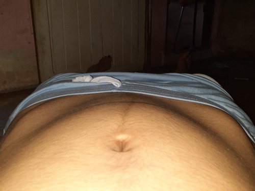 ท้องแบบนี้ปกติมั้ย?