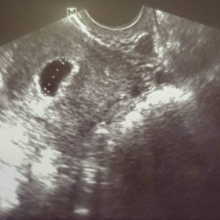 6 weeks
