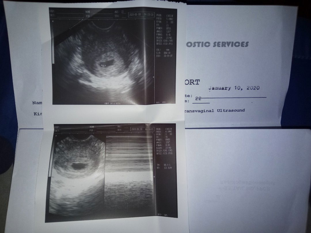 Kaye Dela Rosa profile icon