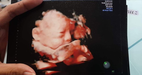Share 3D ULTRASOUND