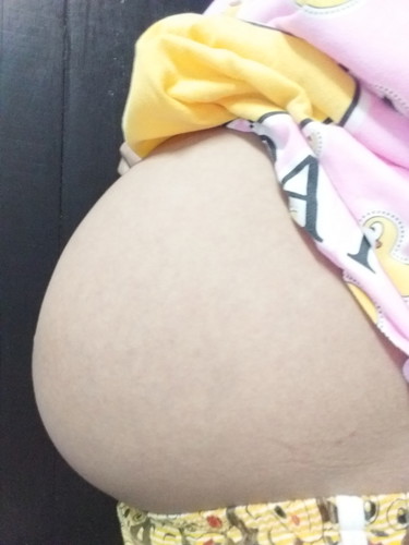 32 w หมอบอกว่าลูกตัวเล็ก