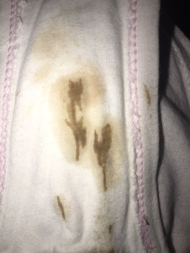 Implantation bleeding? 5 weeks pregnant