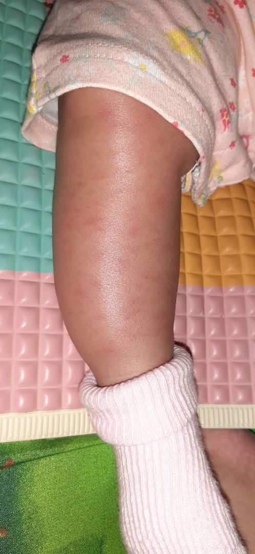 tiba tiba bintik merah