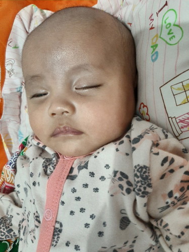 mata mengitip saat tidur