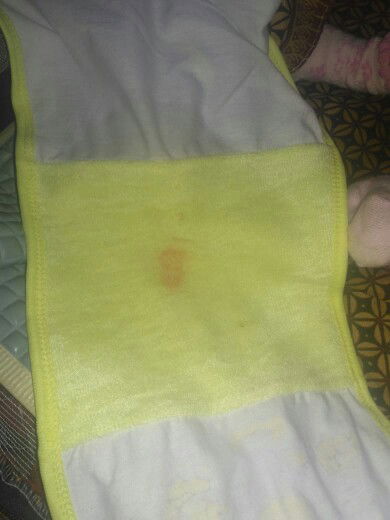 Urin bayi ada bercak merah