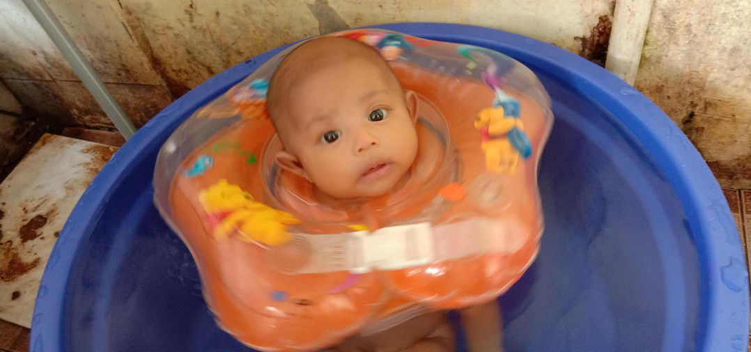 puting lecet,dan berdarah