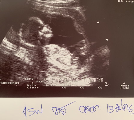 คุณแม่มือใหม่