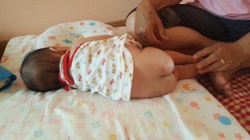 ลูกเป็นตุ่มแดงๆหัวใสๆที่ก้น