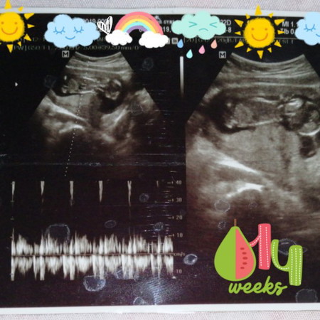 FIRST ULTRASOUND