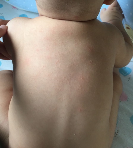 แพ้รึป่าว