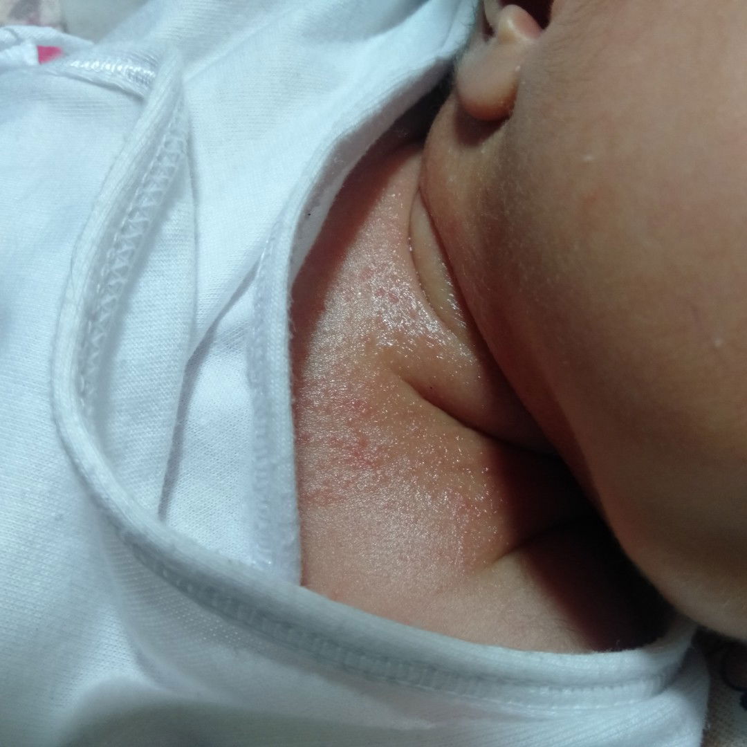 ano po pwede ipanggamot?